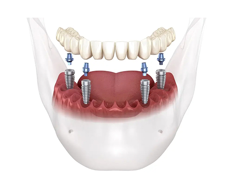 Teeth images