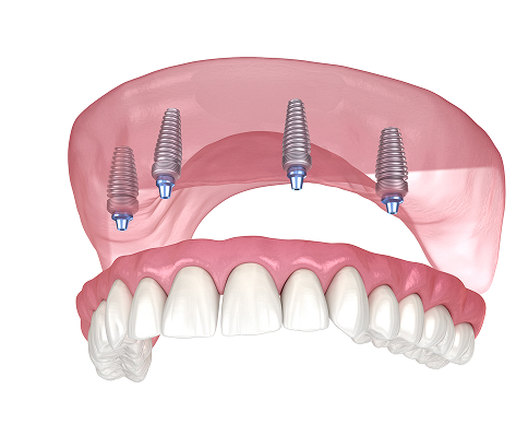 teeth image